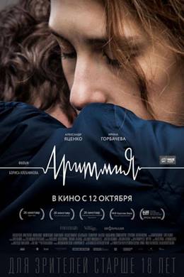 Arrhythmia – Aritmiya