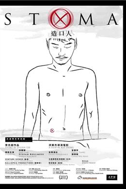 Stoma